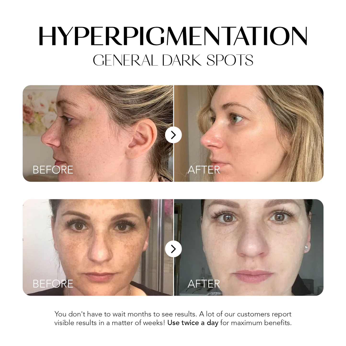 Dark Spot Corrector | 1+1 FREE
