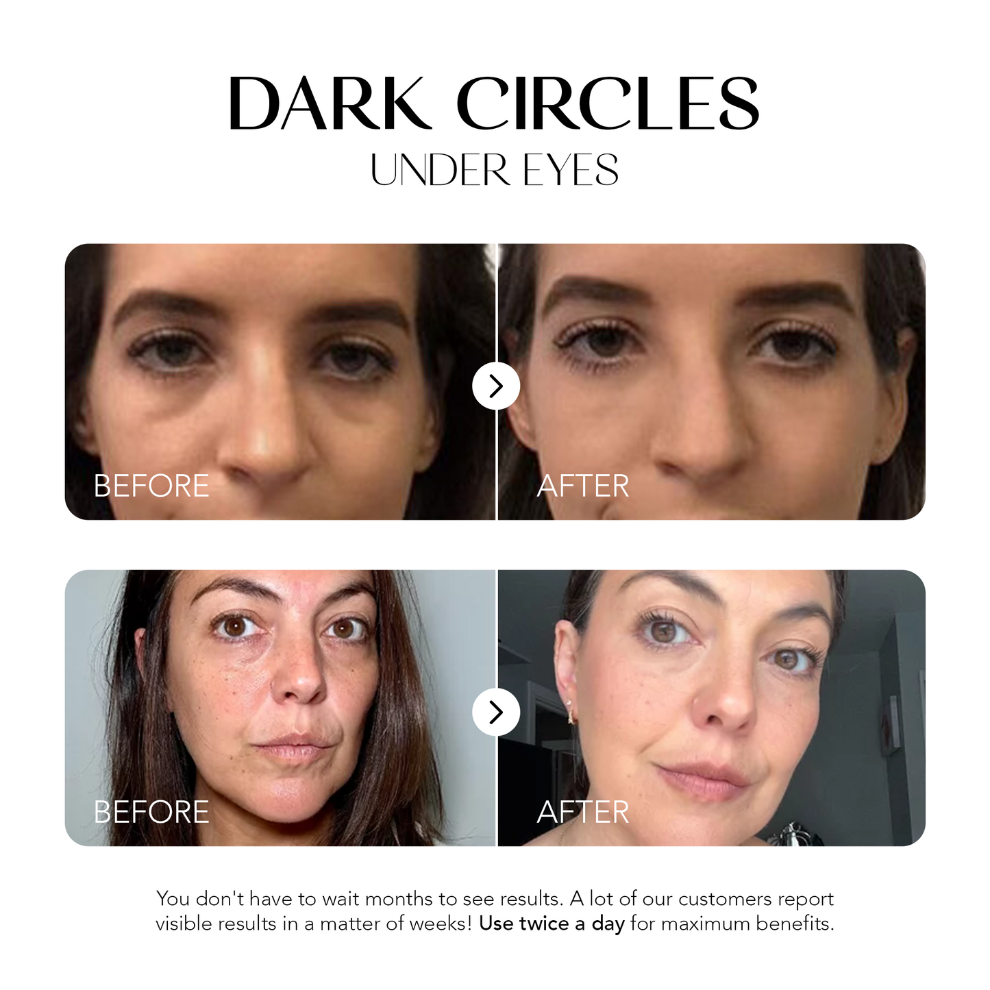 Dark Spot Corrector | 1+1 FREE
