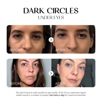 Dark Spot Corrector | 1+1 FREE