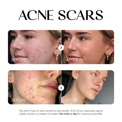 Dark Spot Corrector | 1+1 FREE