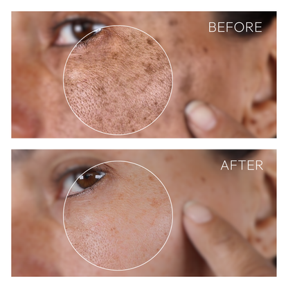 Turmeric Clay Mask Stick