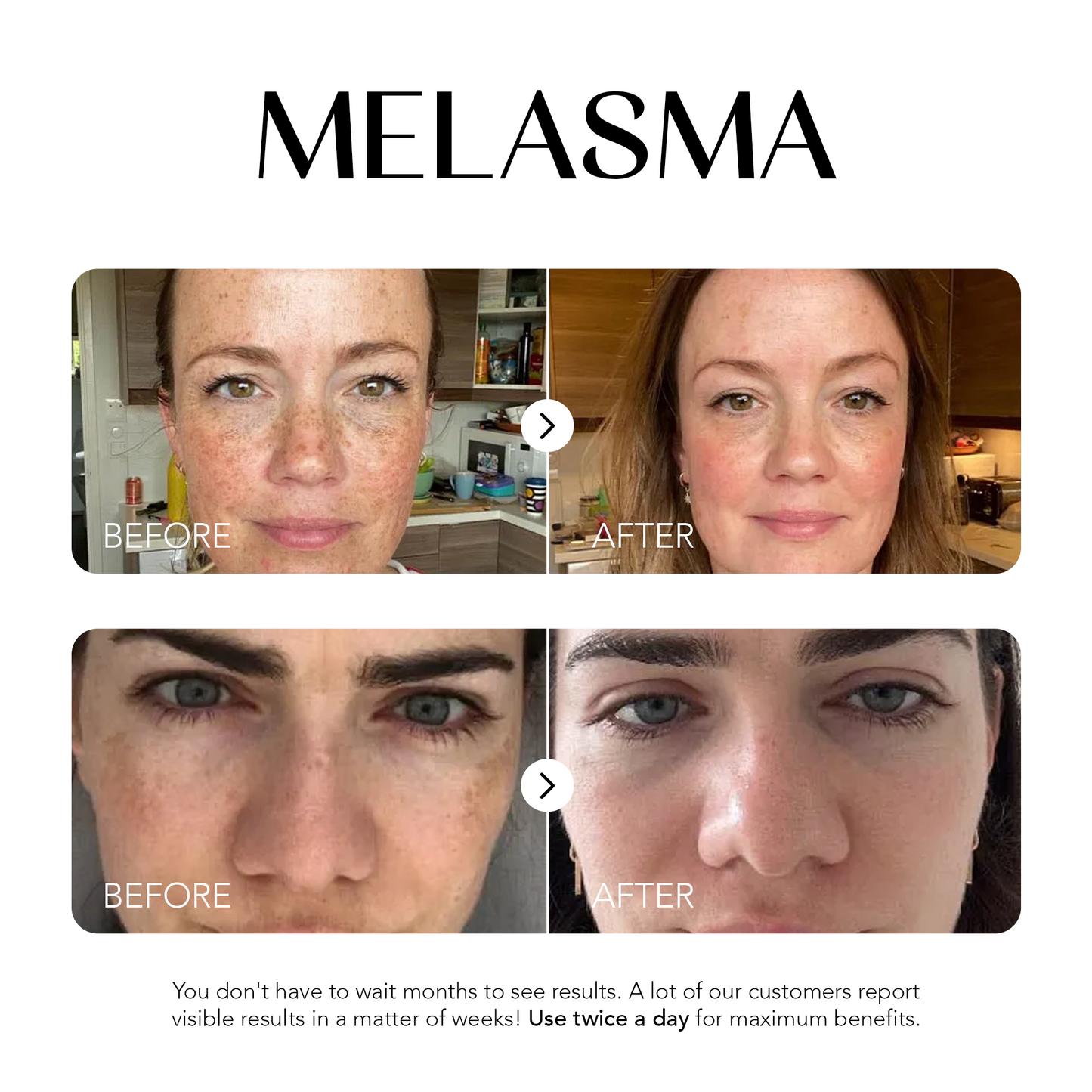 Dark Spot Corrector | 1+1 FREE