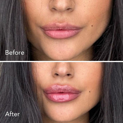 Lip Plumper + Hydrator