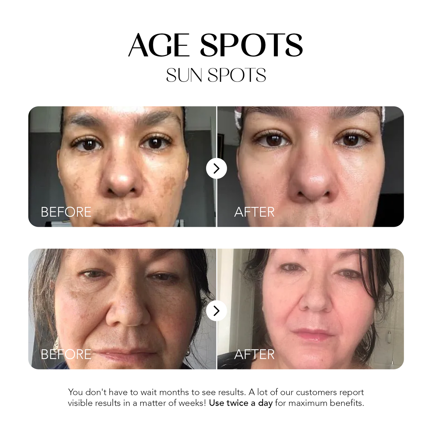 Dark Spot Corrector | 1+1 FREE