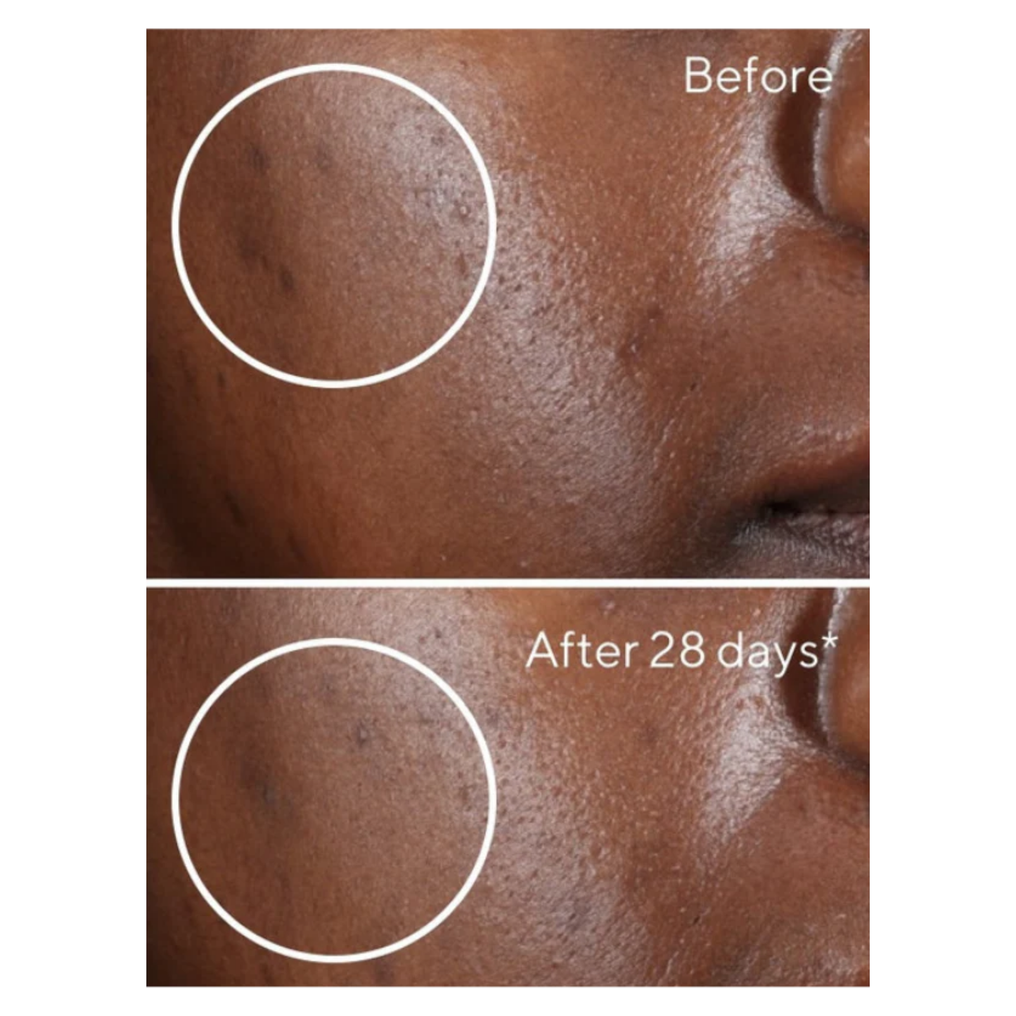 The Complete Dark Spot Solution | Erase & Block